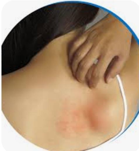 Skin Itchiness and allergy