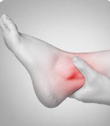 Sprained Ankle or wrist